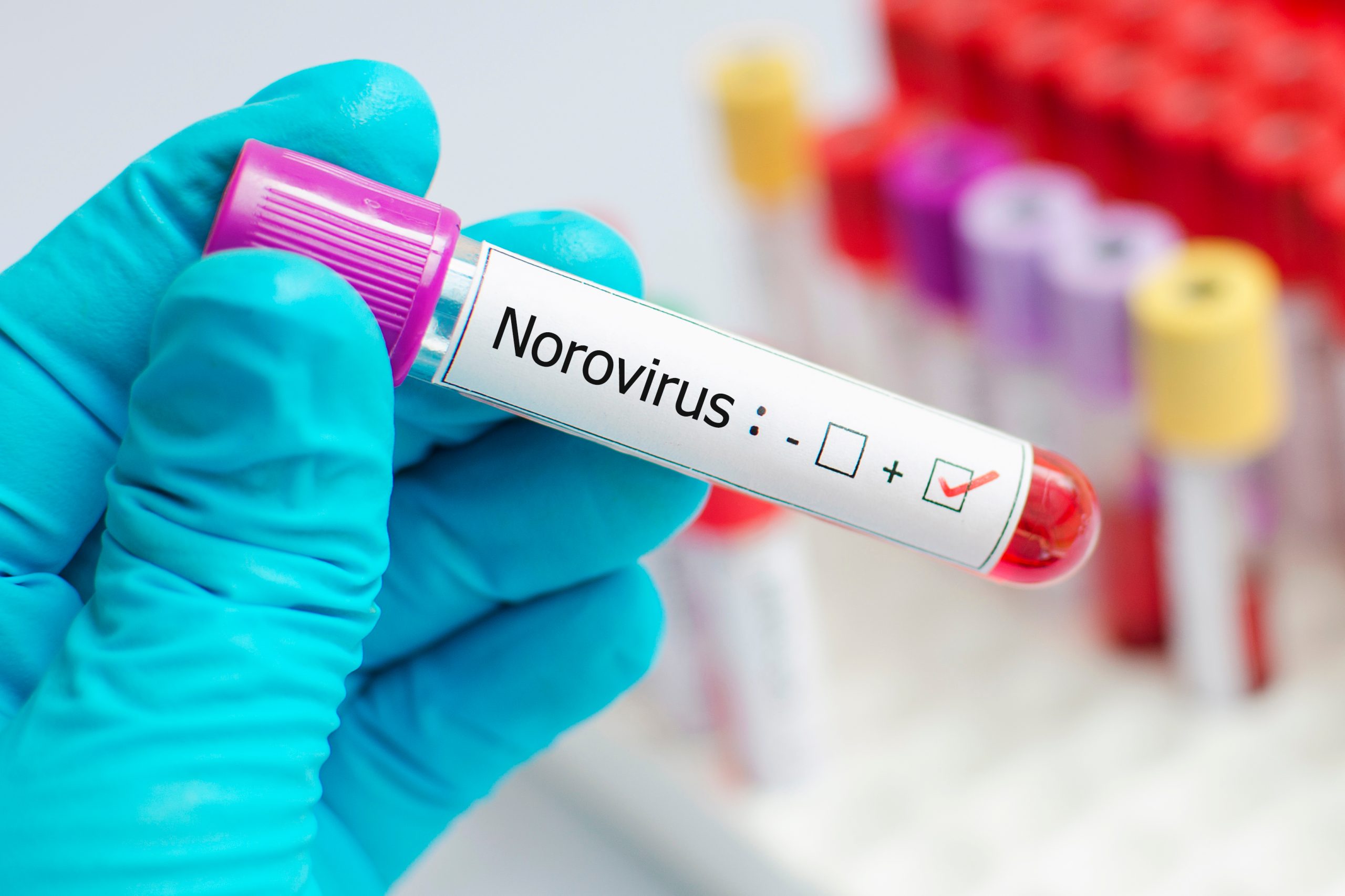 What Is Norovirus, And How Can You Protect Yourself From It?