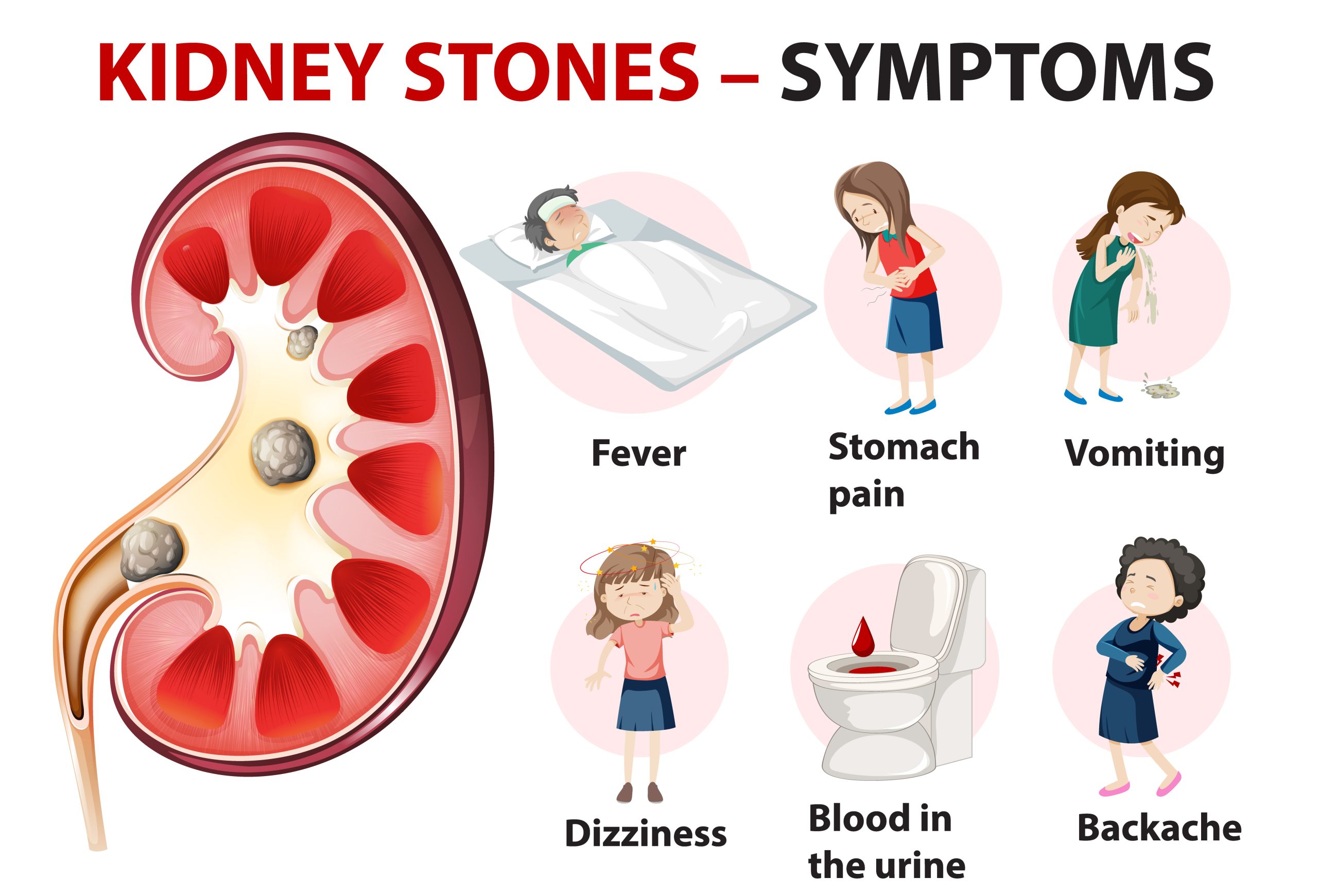 How to Adjust Your Diet to Prevent and Treat Kidney Stones