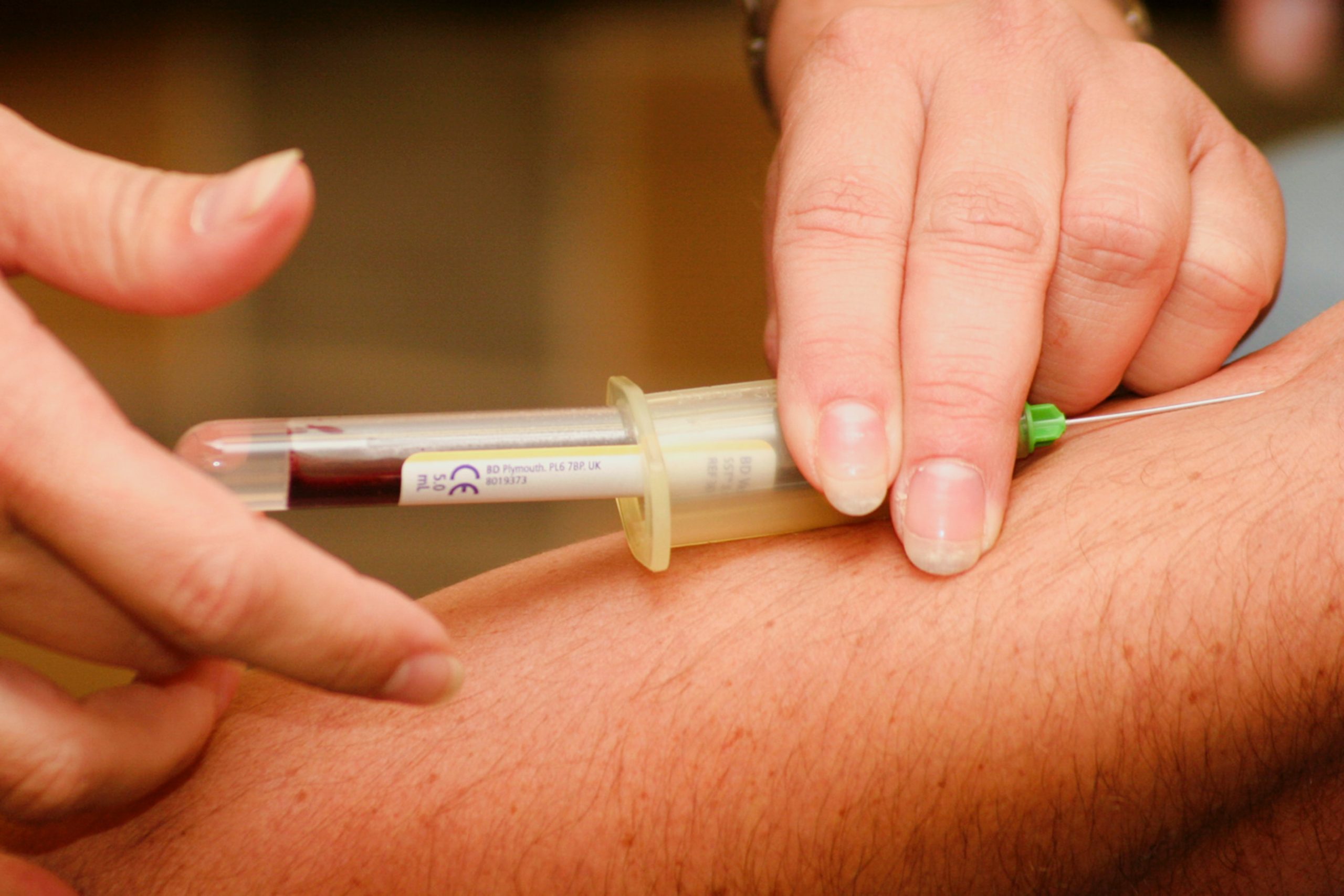 F.D.A. Allows Gay and Bisexual Men to Donate Blood