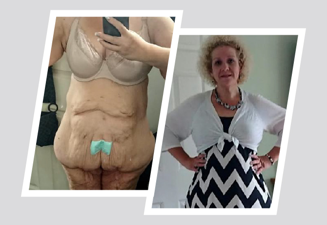 From Happiness to Heartache Astonishing 200-Pound Weight Loss Causes Major Setback in the Bedroom