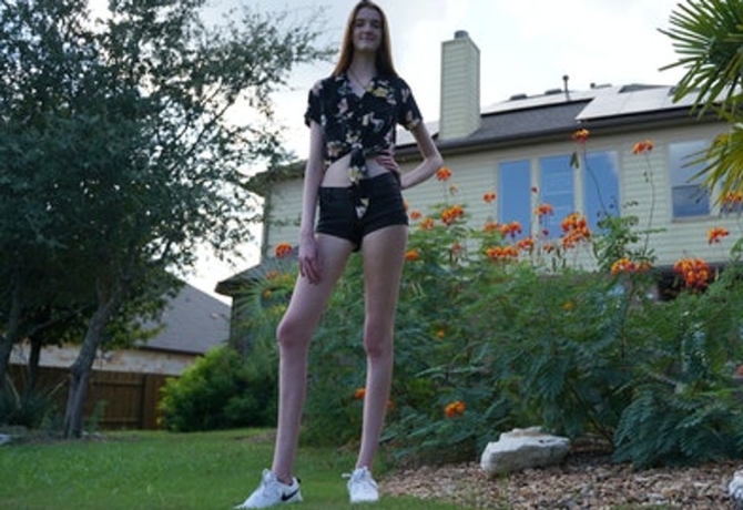 Longer Than Ever Meet the Woman Whose Legs Reach Unimaginable Lengths!