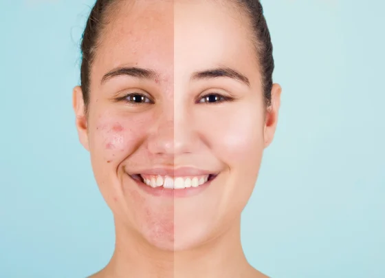 Unlock Your Best Skin Yet with Skin Cycling: Here's Why