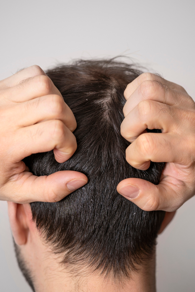 Understanding Dry Scalp: Common Causes and Symptoms Explored by Dermatologists