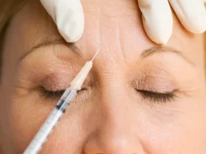 Botox's Proactive