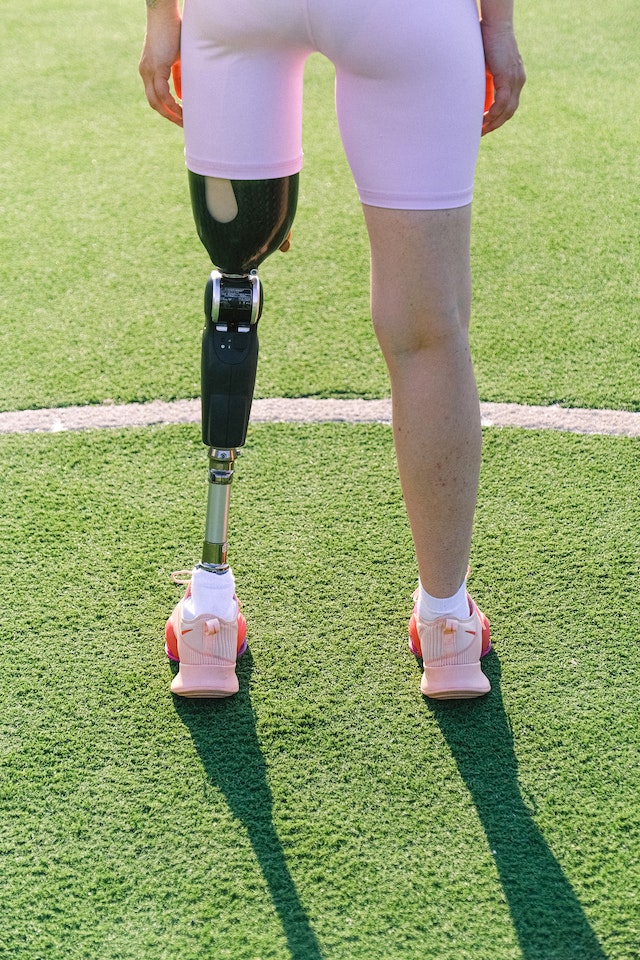 Fractured Leg Recovery Strategies for a Speedy Healing