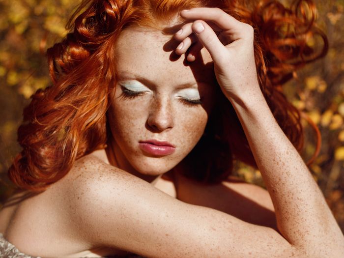 Natural Ways to Banish Freckles