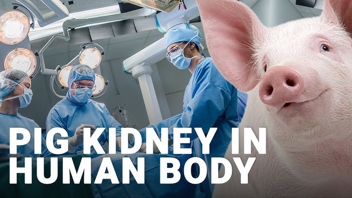 The Pig-Kidney Connection: Pioneering Organ Regeneration