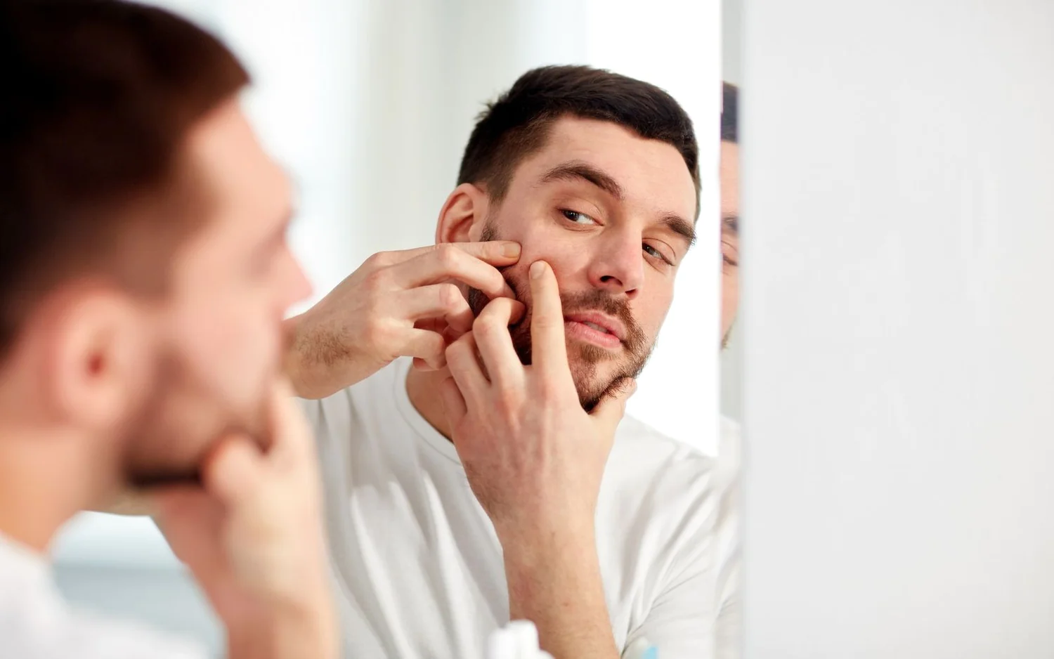 Steer Clear of Common Acne Pitfalls