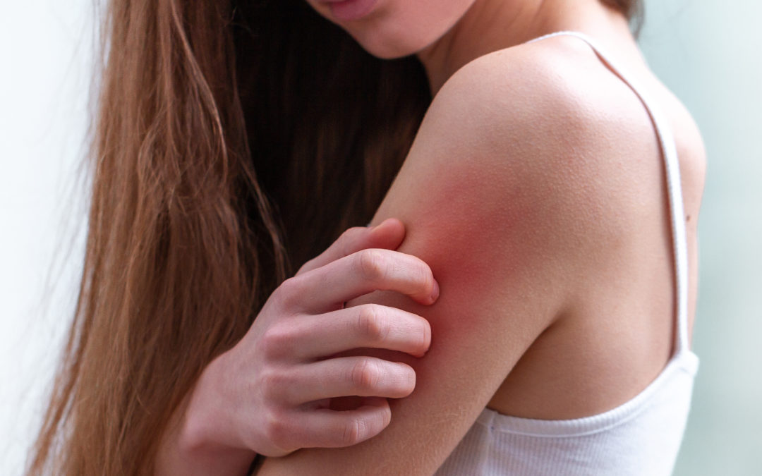 Skin Health Matters: Common Skin Diseases and Conditions