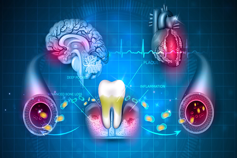 Complex Connection Between Race and Heart Health