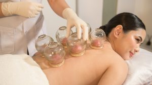 Impact of Cupping