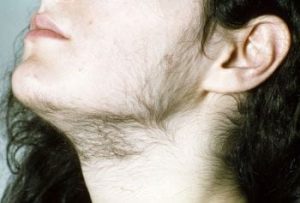 Mysteries of Body Hair 