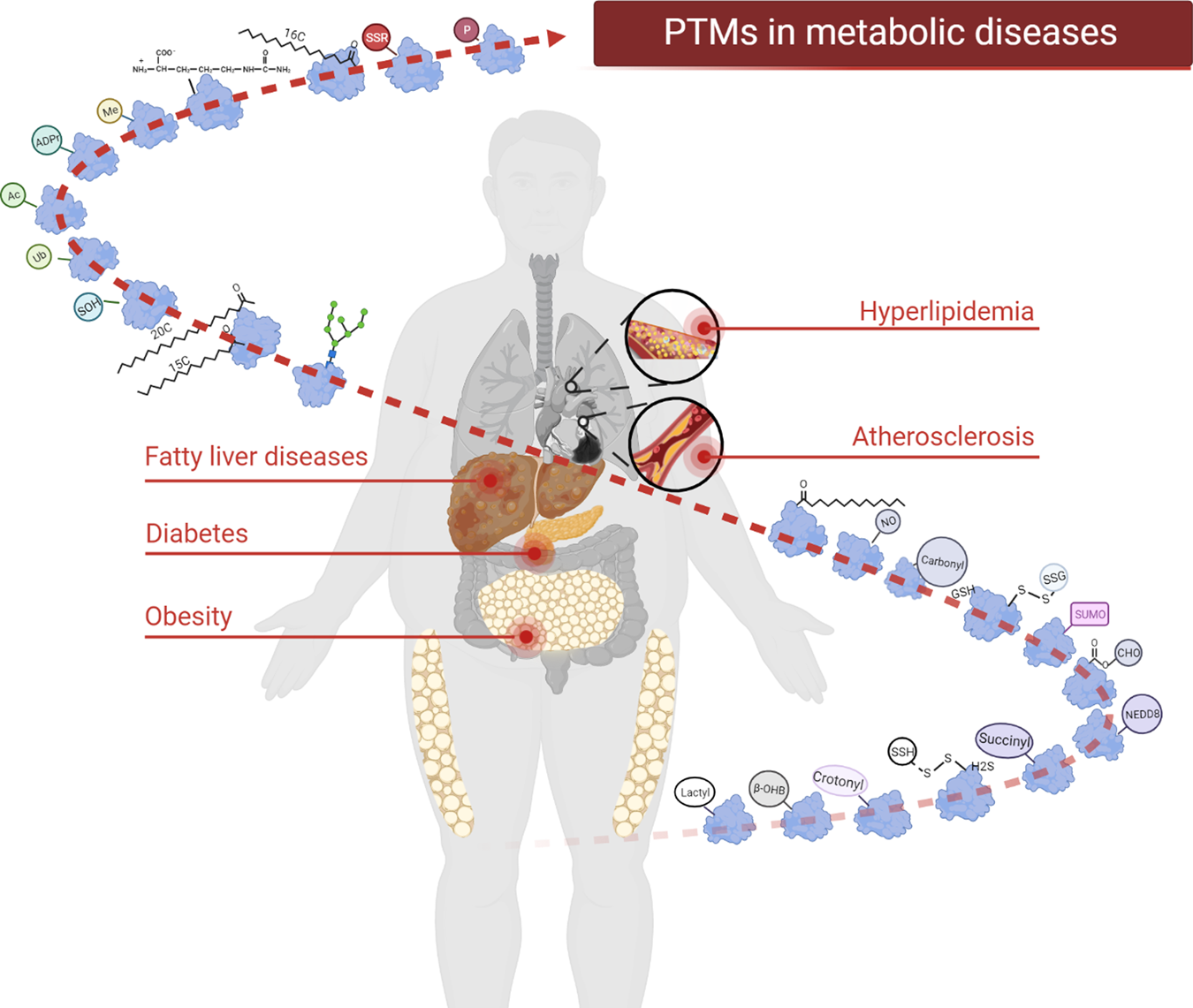 Metabolism, Inflammation, and Cancer Progression: Interconnected Pathways Unveiled