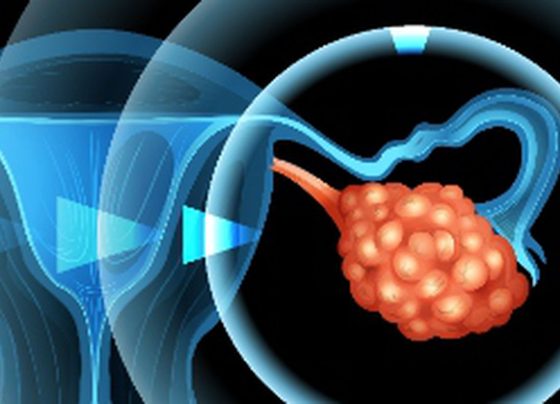 Ovarian Cancer Detection