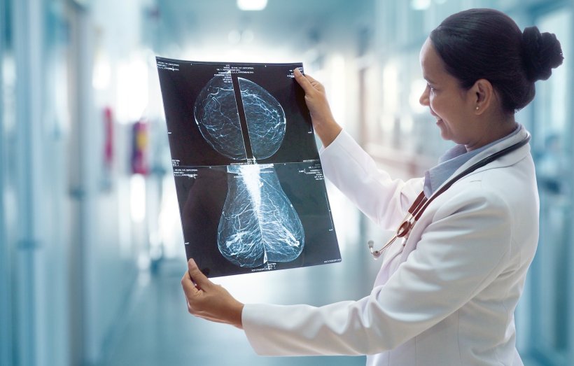 AI Revolutionizing Breast Cancer Detection: Enhancing Accuracy and Hope