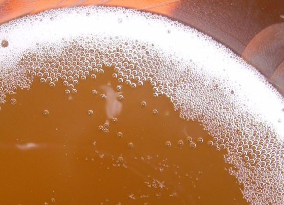 Beer-Like Urine