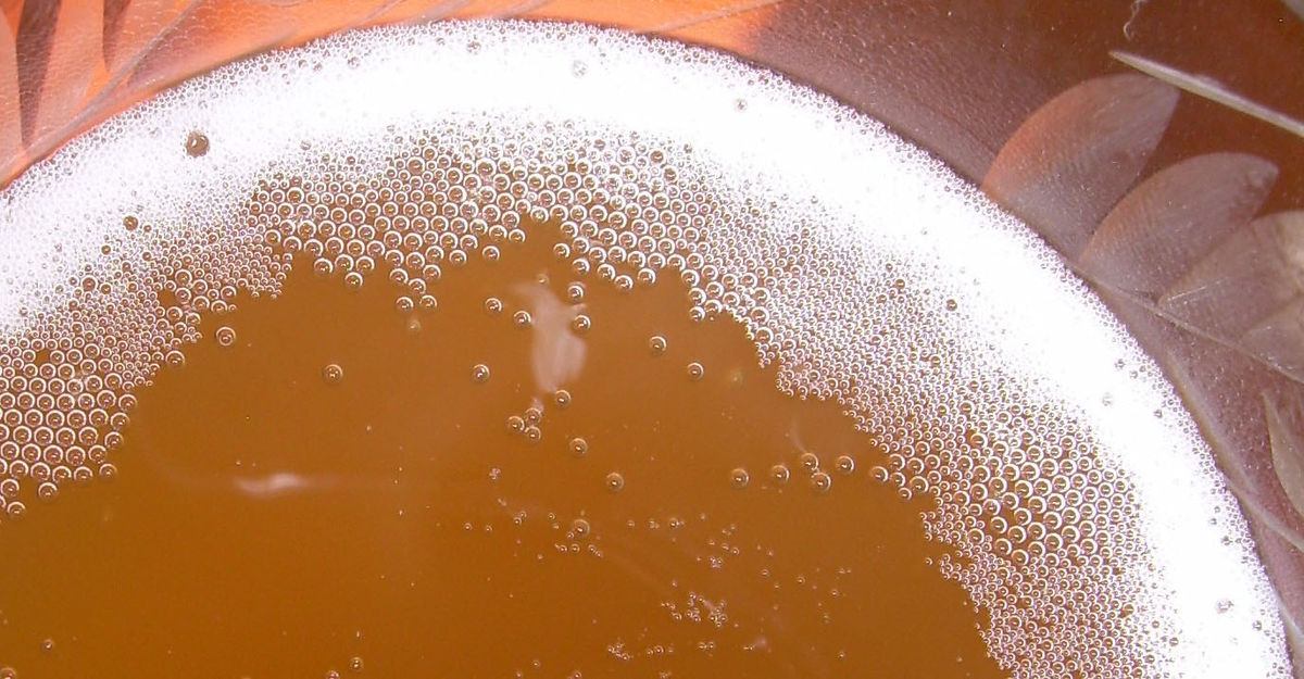 When Pee Mimics Brew: 5 Explanations for Foamy, Beer-Like Urination