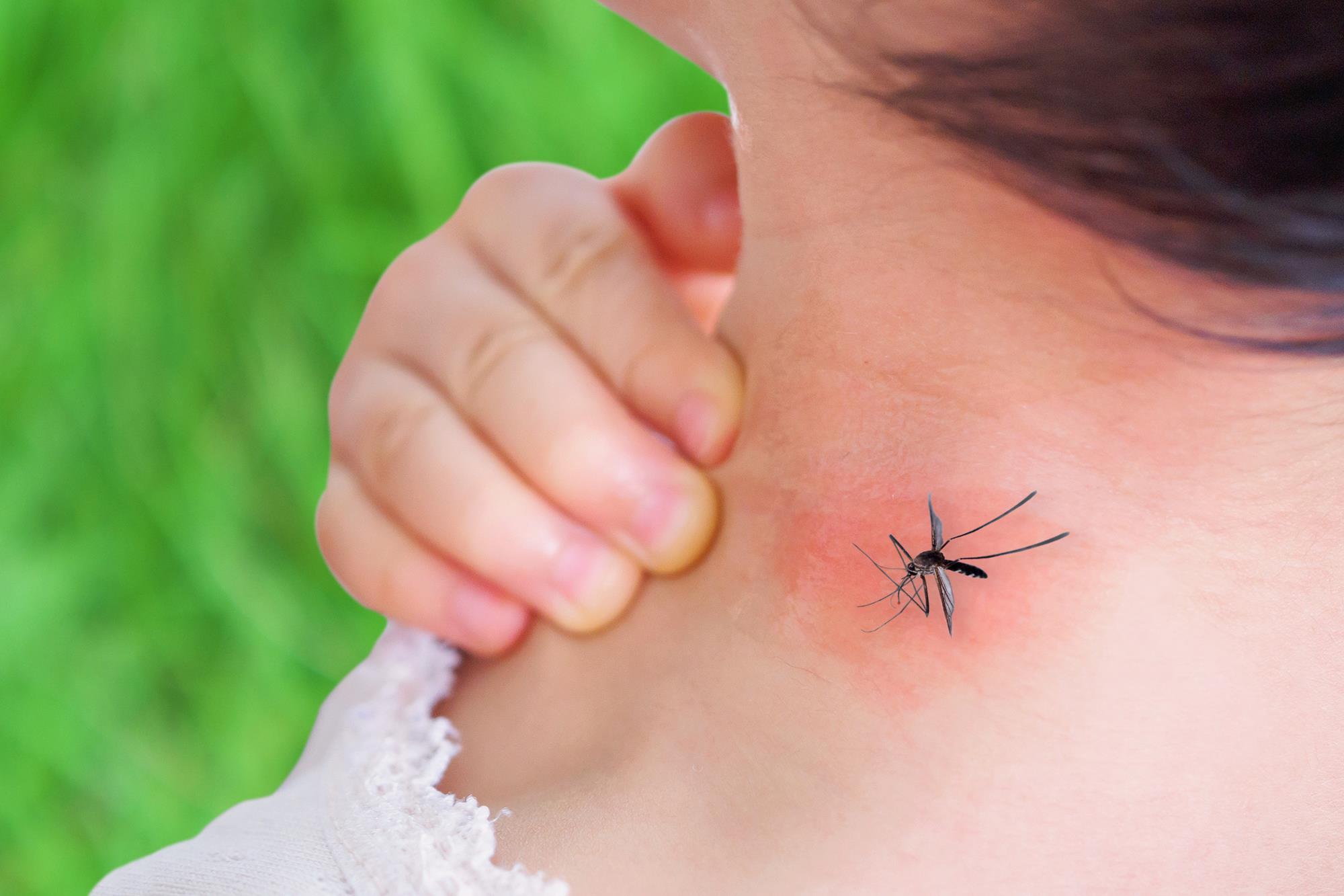 When Bugs Bite: Knowing About Allergies to Insect Stings