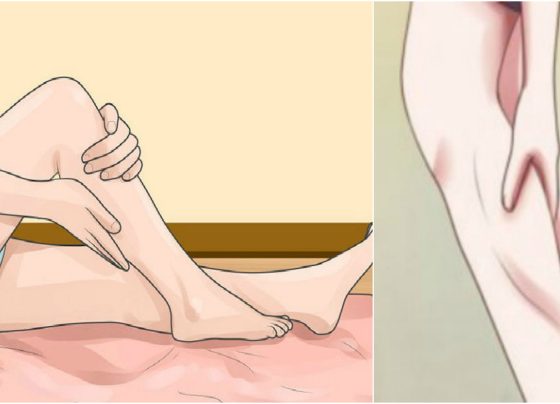 Managing Leg Cramp