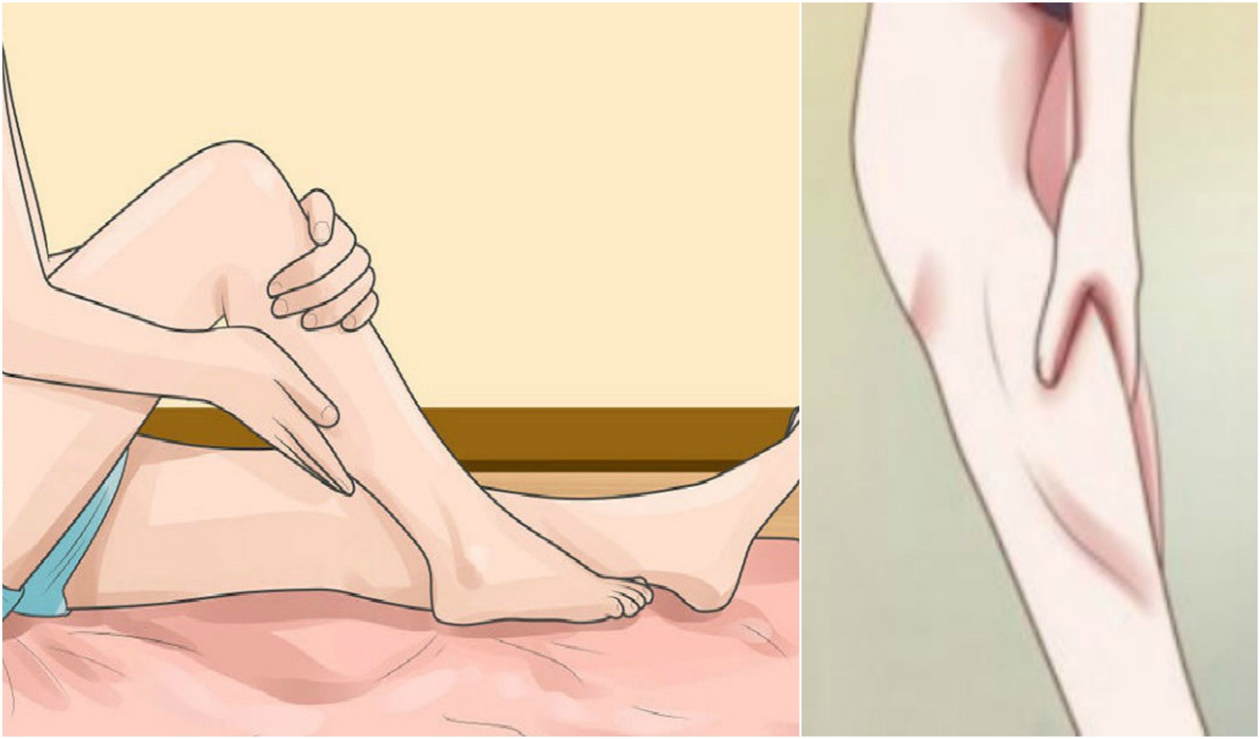 Understanding and Managing Leg Cramps: A Expert Guide