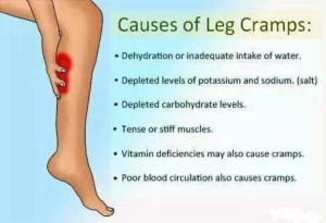 Managing Leg Cramp