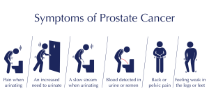  prostate cancer