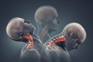  Head and Neck Cancer