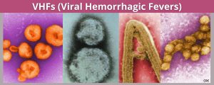 Hemorrhagic Fevers