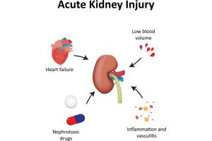 Dialysis Types