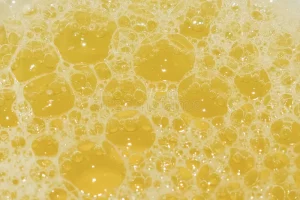 Beer-Like Urine 