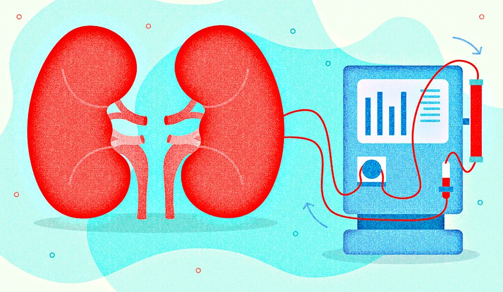 Dialysis – Types, Effectiveness, Side Effects