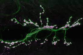  Central Nervous System