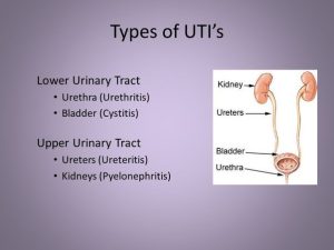 Urinary Tract Infection