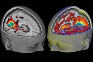 Psychedelics and the Brain