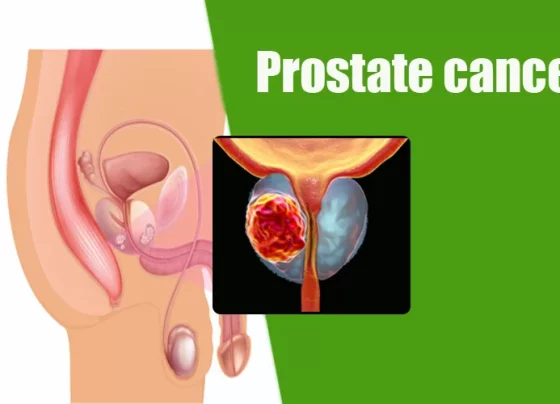 prostate cancer