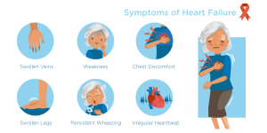 Heart Failure Signs