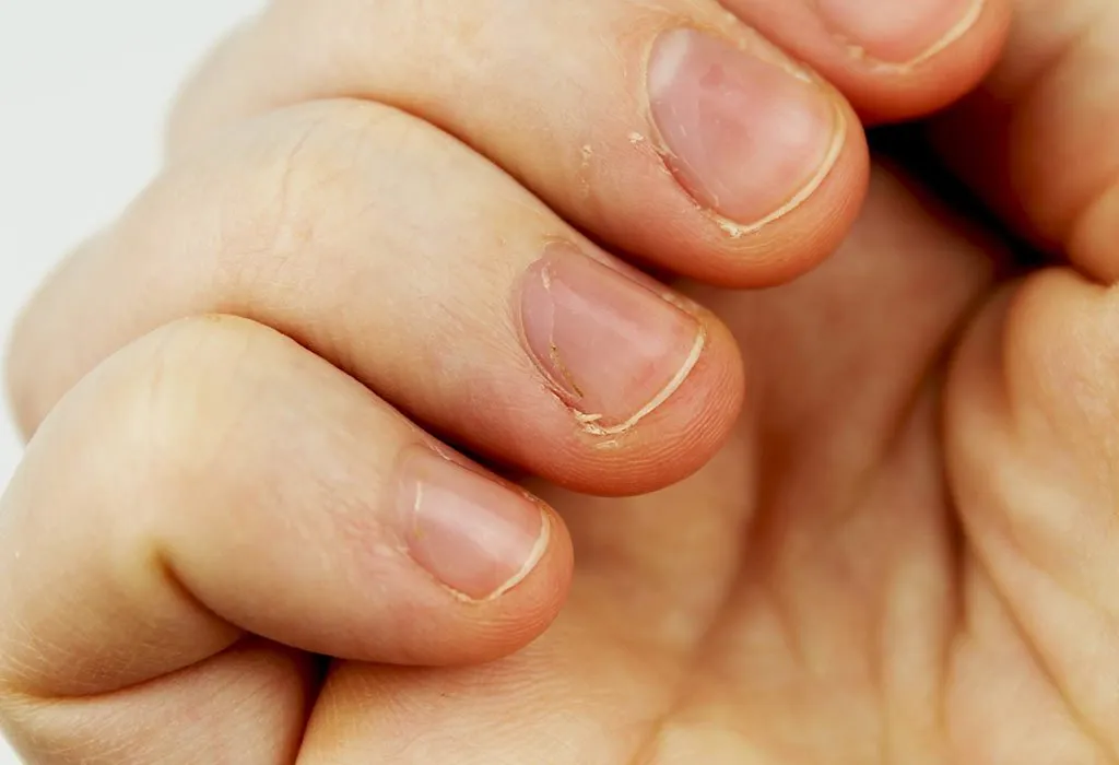 White Out: Understanding Nail Problems and Their Causes