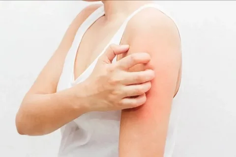 When a Rash Isn’t Just Skin-Deep: Signs of a Serious Problem