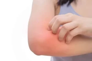  Signs That Cellulitis