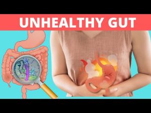 Signs of an Unhealthy Gut