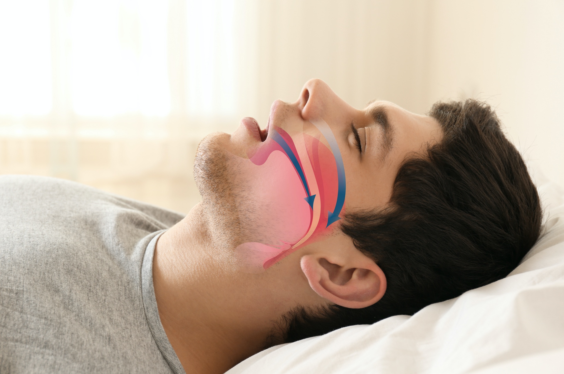 Why Sleep Apnea Harms Your Bones and Teeth