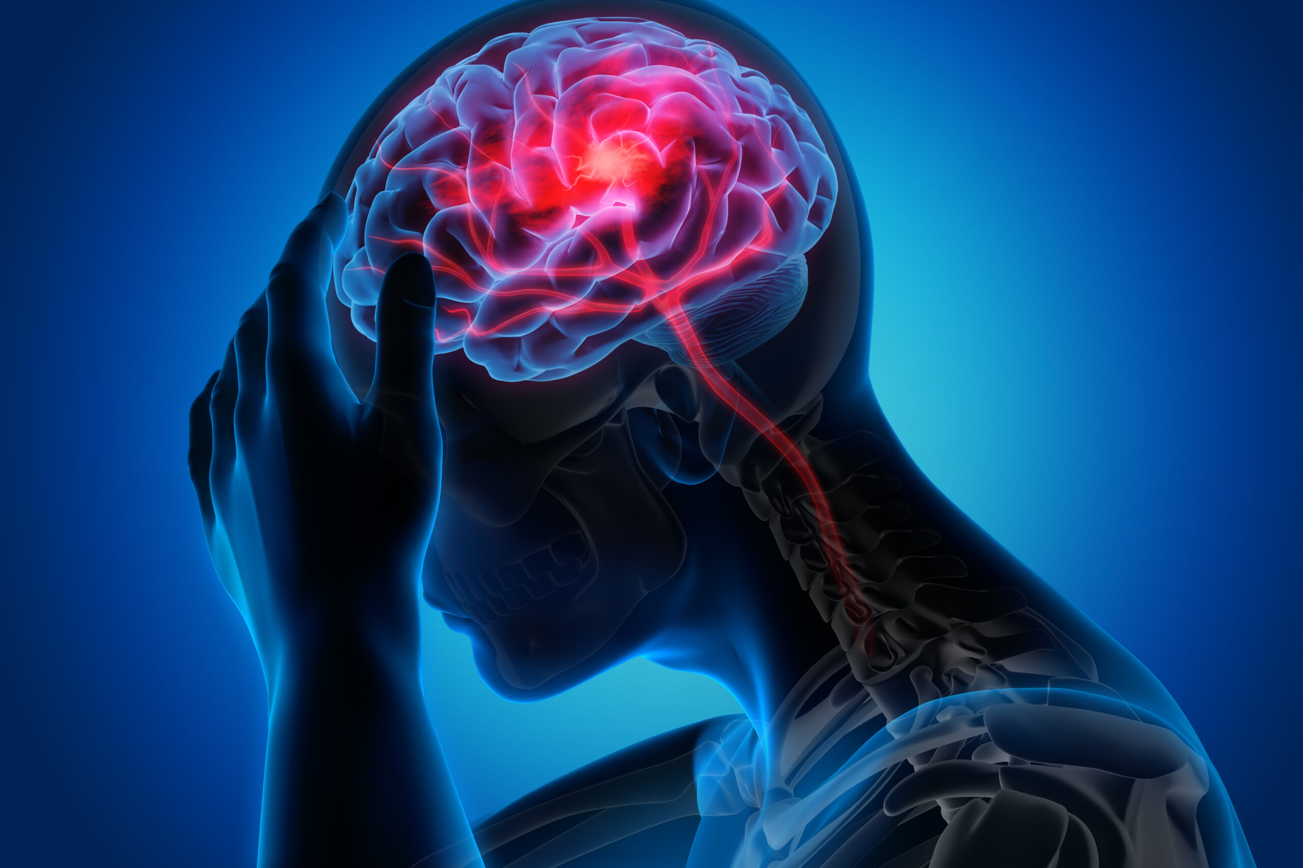 Spotting Concussion: Signs to Watch For After a Bump to the Head