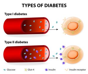 Diabetes Risk