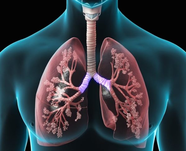 Improve Lung Function in Children with Lifestyle Changes