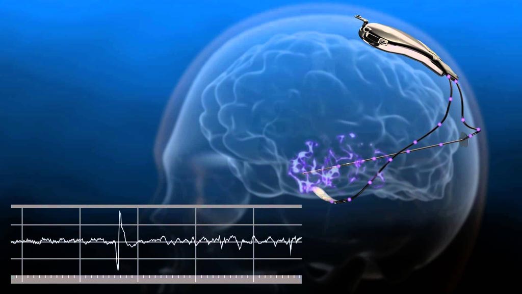 Developments in Mental Health Treatments: What's on the Horizon?