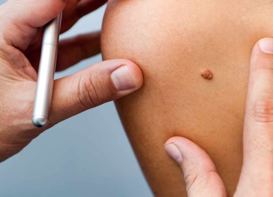 New Technologies in Skin Cancer Screening: What’s Next?