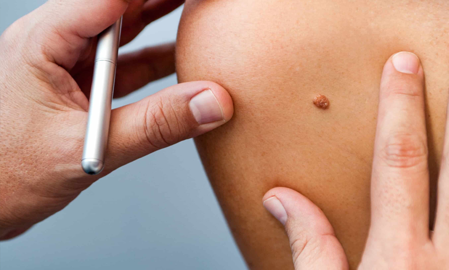 New Technologies in Skin Cancer Screening: What’s Next?