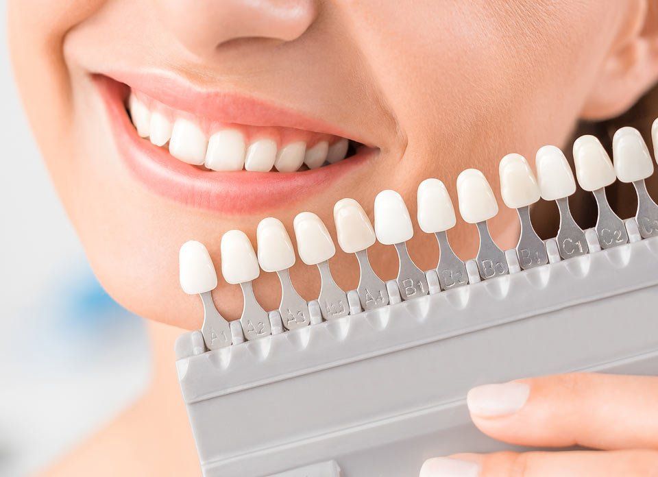 Benefits of Visiting a Cosmetic Dentist Mumbai for Teeth Whitening